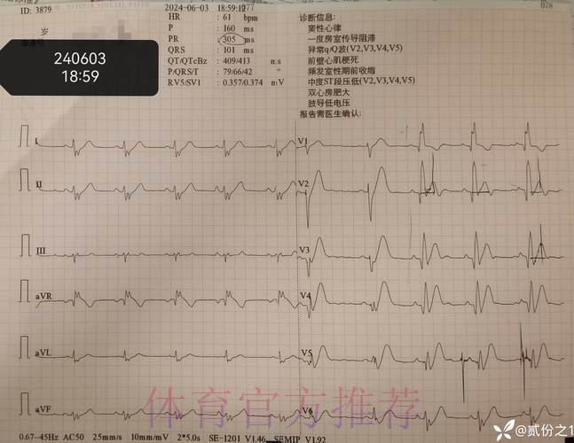 莫德里奇出现发烧症状 经检查已排除新冠感染 莫德里奇出现发烧症状 经检查已排除新冠感染